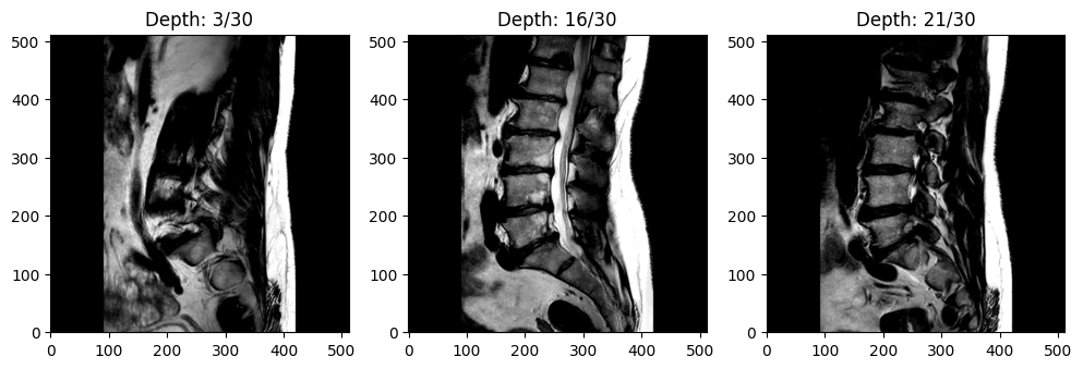 Example MRI Image
