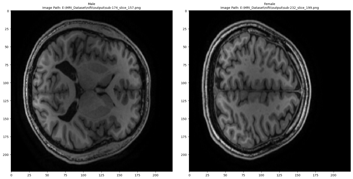 T1w MRI Brain Slices Sample
