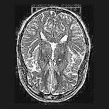 mri1027.jpg