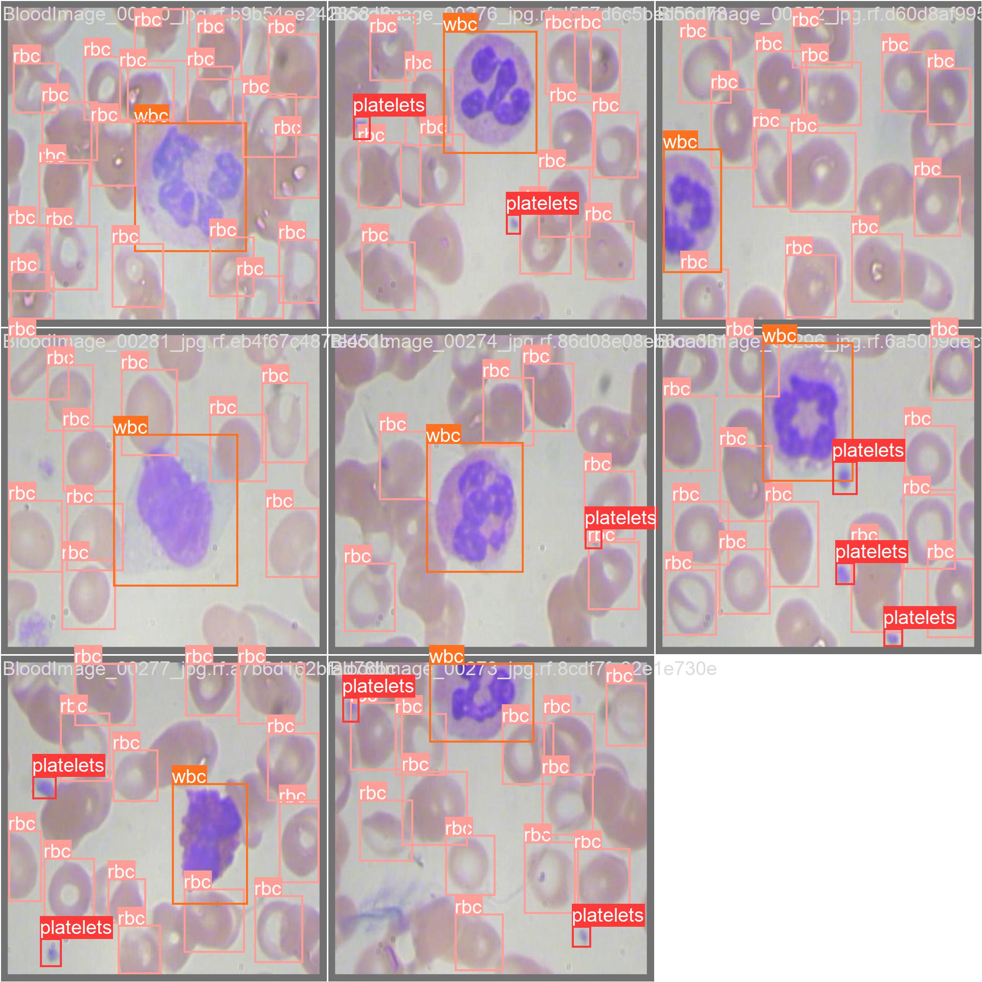 keremberke/yolov5s-blood-cell
