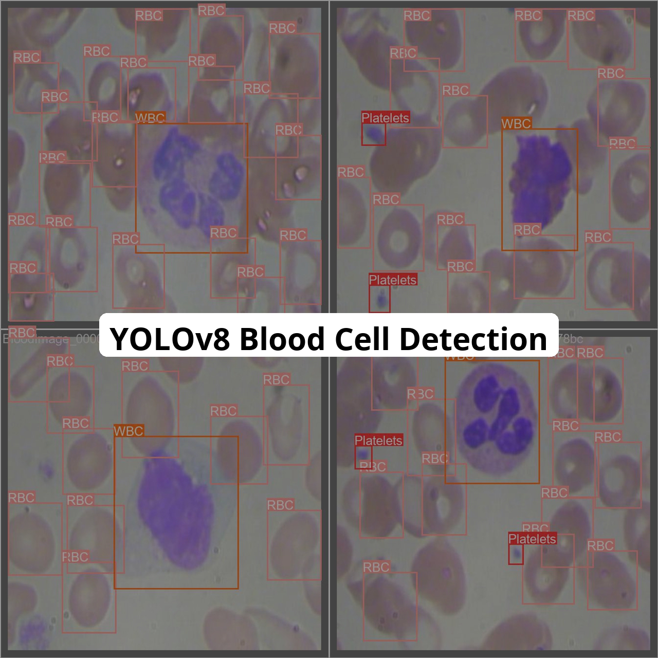 keremberke/yolov8m-blood-cell-detection