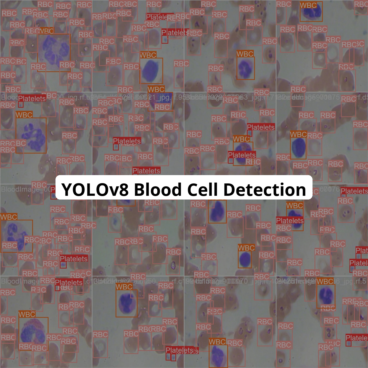 keremberke/yolov8s-blood-cell-detection
