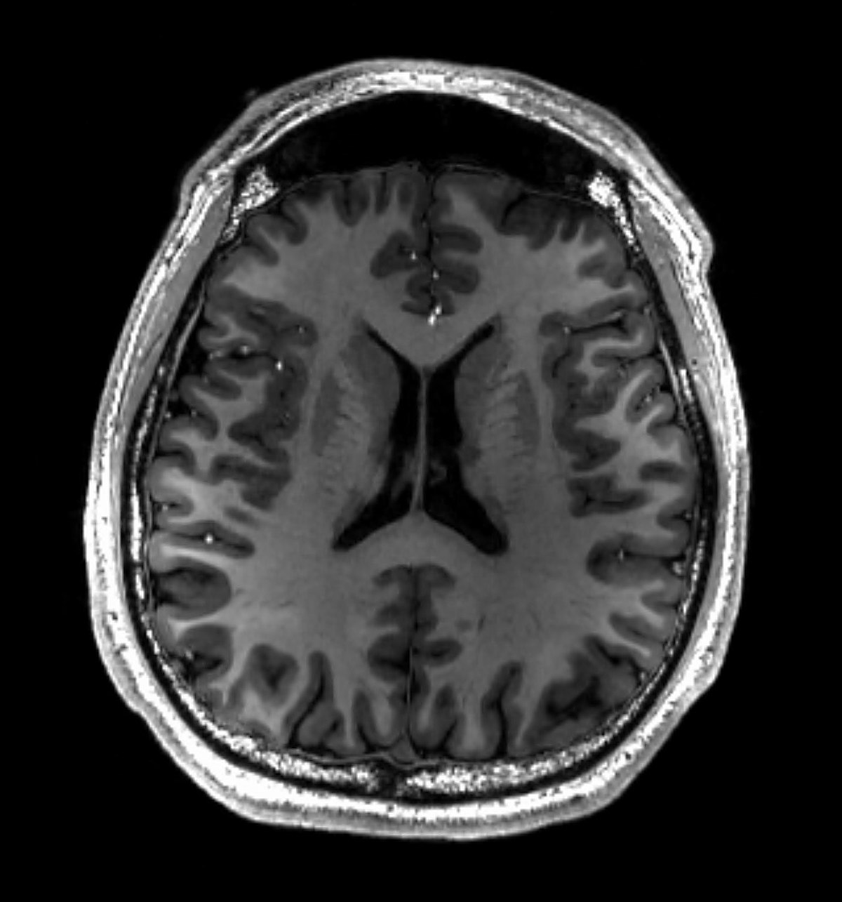 brain_MRI.jpg