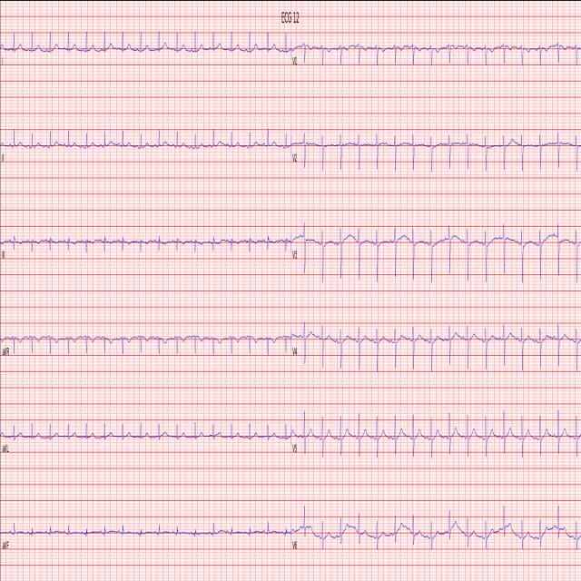 DHEIVER/ecg-ialjy-yolov8-obb at main