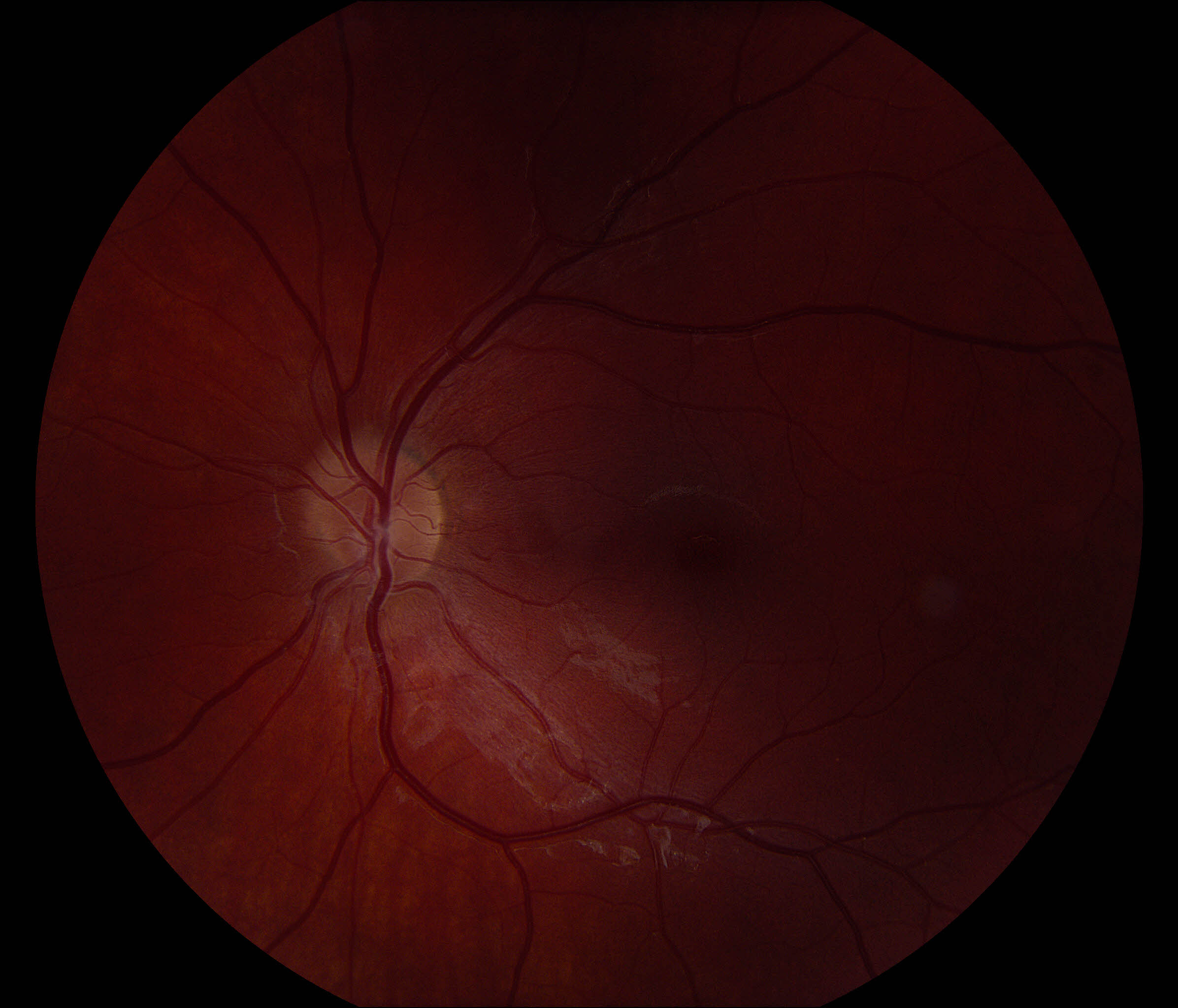 Fundus.jpg