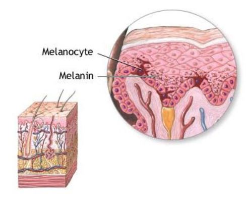 melanocyte.JPG