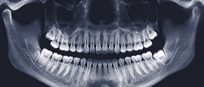 teeth_05.png