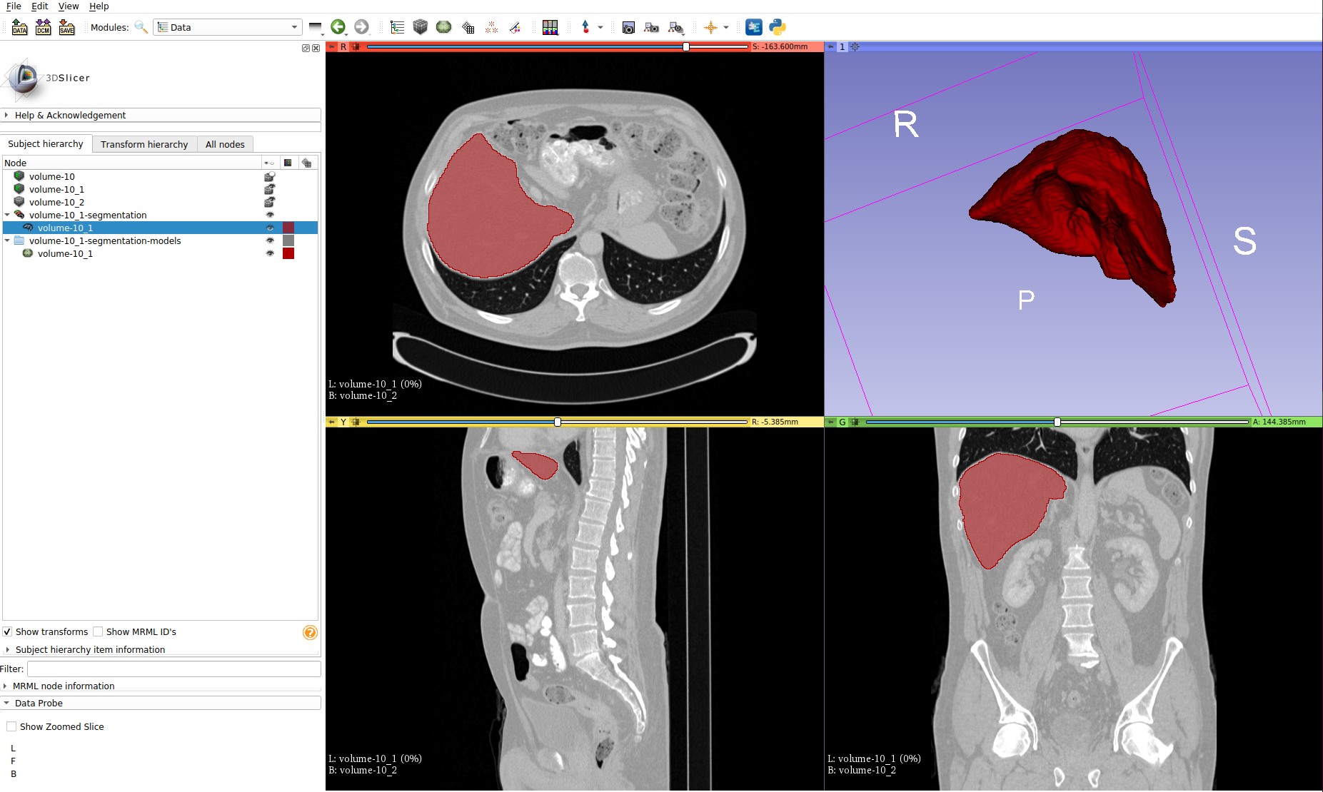 Segmentation_3DSlicer.PNG