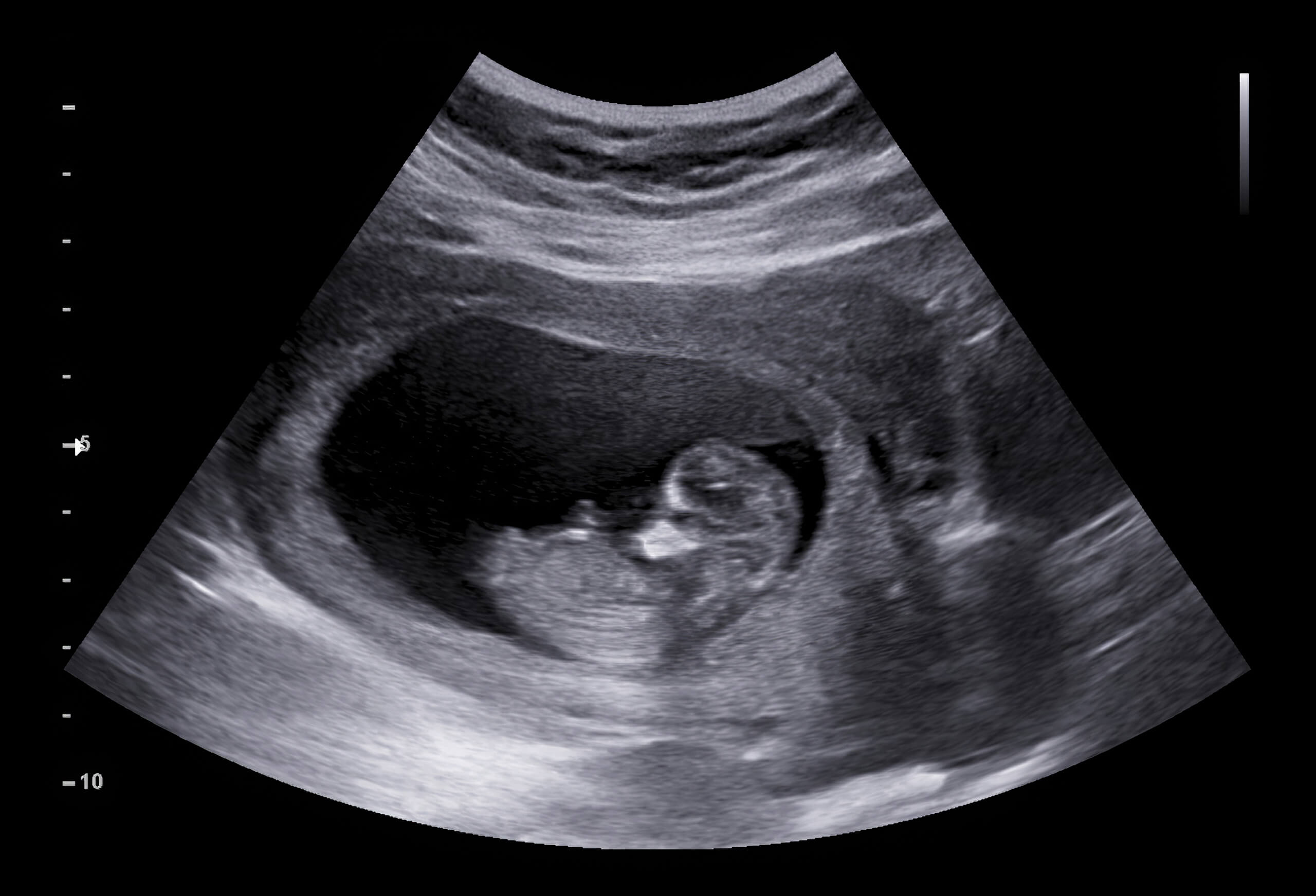 ultrasound.jpg