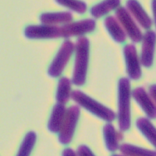 Clostridium.perfringens_sample.png