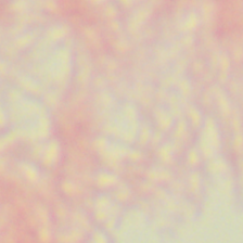 Fusobacterium_sample.png
